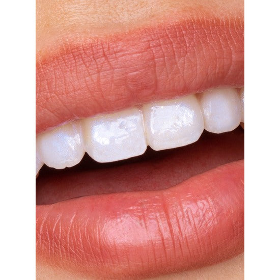 Glostik Tandglans - Perfect voor witte tanden